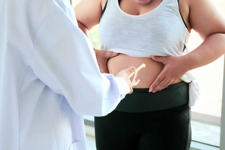Belly Fat