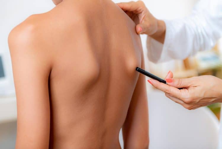 Pediatric Doctor Examining Posture