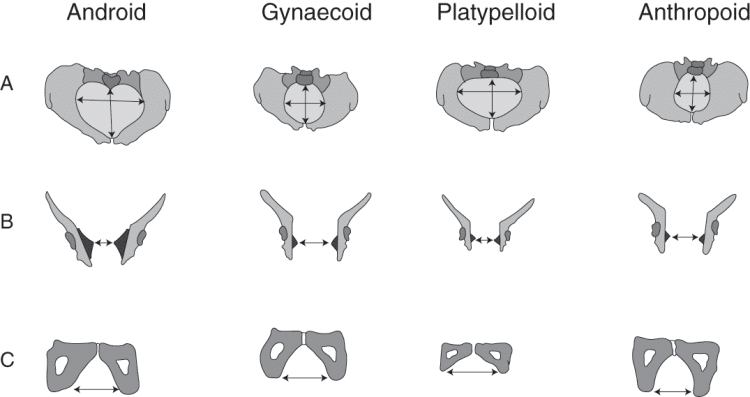 Bony Pelvis